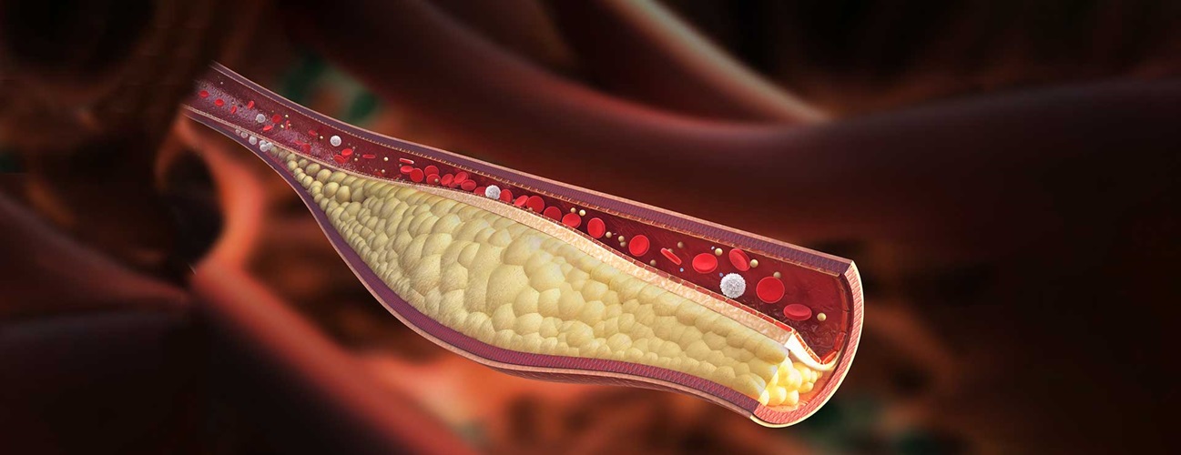 The Most Effective Cholesterol Supplements In 2022 – A Buyer’s Guide